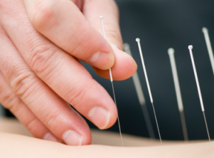 Az akupunktúra kezelésére vesebetegség - kezelésére vesebetegség