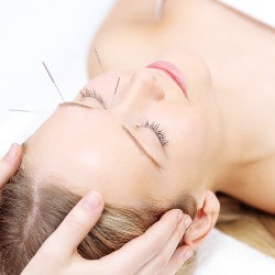 Acupunctura - o metoda de tratament a migrenei - portalul 