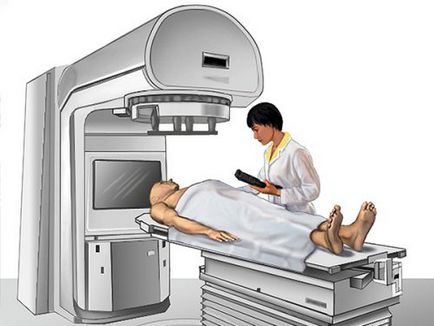 Az immunterápia, melanoma, kemoterápia, célzott, sugárkezelés