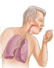 Cum să alegeți nebulizatorul exact ce nebulizatoare sunt ca să aibă grijă de un nebulizator