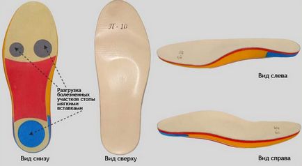 Як вибрати ортопедичні устілки для дитини і дорослого, правильний підбір взуття