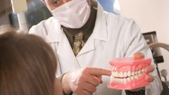Hogyan válasszuk ki a fogászati ​​korona - hogyan lehet eltávolítani a korona a fog - hi-tech - egyéb
