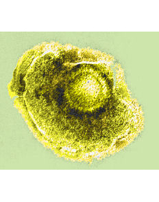 Cum arată virusul varicel zoster?