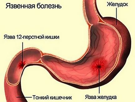 Картопляний сік - користь і шкода для організму