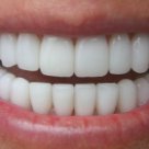 До чого вам приснилося, що зуби великі виросли значення снів про зубах