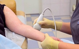 A kezelés lymphostasis után kezet egy mastectomia (eltávolítása emlőrák)