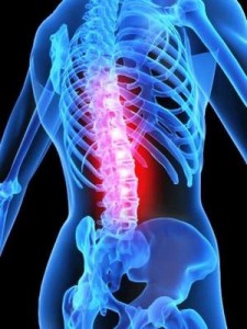 Лікування народними засобами остеопорозу - причини розвитку, симптоми, рецепти при остеопорозі