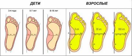 Tratamentul picioarelor plate în Moscova - centru medical