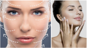 Nyirokmasszázs arcmasszázs jobb szike, hasznosságát Botox