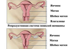 Debutul menopauzei la femei este modul în care se declanșează lunar