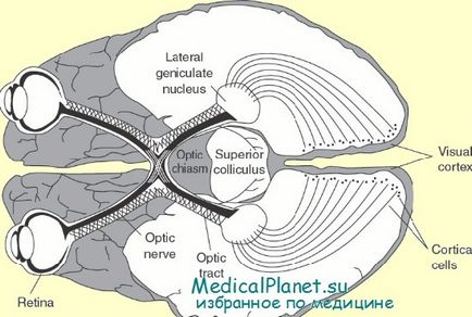 Atrofia ereditară a nervului optic al leberului la copii, diagnostic, tratament