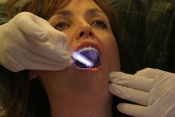 Онкоскринінгу в стоматології