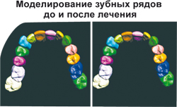 Ортодонтичні капи, вісник медinfo, красноярська медична газета (онлайн-версія)