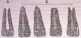 Caracteristicile tehnicii endodontice la copii