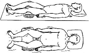 Fractură a simptomelor pelvisului, diagnostic, tratament, pune în pericol viața