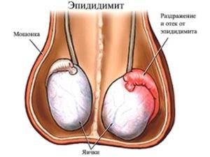 De ce copilul are un testicul, testicul durere testiculară la un băiat