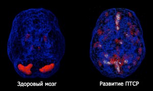 Afecțiuni post-traumatice cauze, simptome, diagnostic