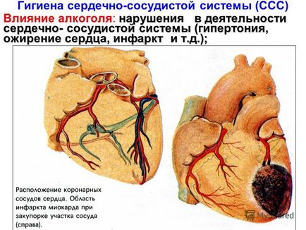 Prezentarea pe tema sănătății cardiovasculare este scopul lecției de a fi copleșit de principalele