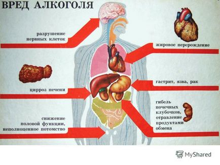 Prezentarea pe tema sănătății cardiovasculare este scopul lecției de a fi copleșit de principalele