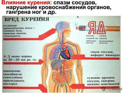 Prezentarea pe tema sănătății cardiovasculare este scopul lecției de a fi copleșit de principalele