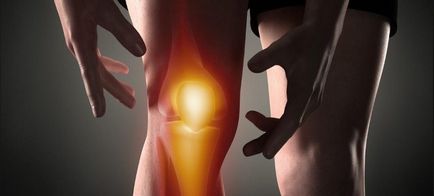 Розтягнення зв'язок колінного суглоба лікування в домашніх умовах