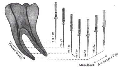 Skye - endodonția clinică