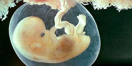 Interpretarea embrionului în visul unui embrion într-un vis