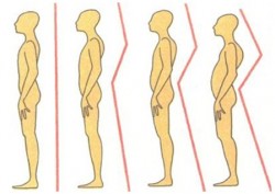 Înclinația și starea generală a corpului