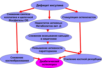 види остеопорозу