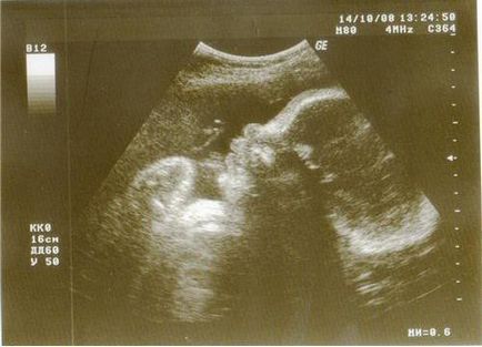Optna luna de sarcina, dezvoltarea fetala, fotografie