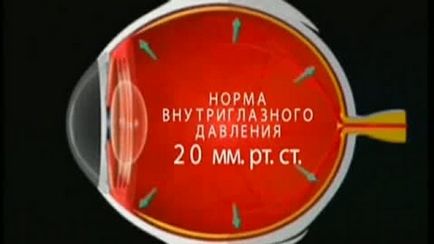 Можливі ускладнення після заміни кришталика ока при катаракті