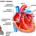 Atrezia arterei pulmonare 1