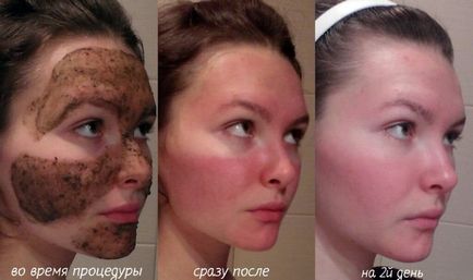 Badyaga лице - и използването на маски рецепти, цена и прегледи, кожата преди и след снимки