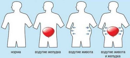 Що можна їсти, коли болить шлунок зразкове меню, загальні принципи харчування