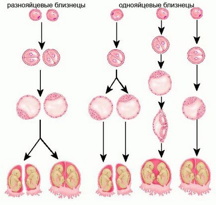 Lányok! Ki diamnioticheskaya monochorialis, chorion jel azt