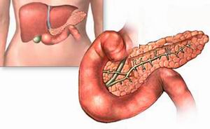 Hyperfuncția și hipofuncția pancreasului, simptomele, ceea ce duce la ceea ce se dezvoltă dacă