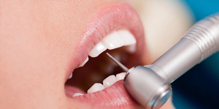 Гіпоплазія емалі зубів причини виникнення та лікування