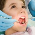 Cum sa tratezi gingivita catarala la copii, simptome si tratament