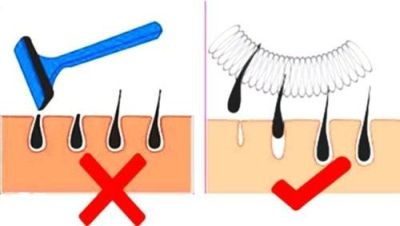 Hogyan lehet eltávolítani a szőr a felső ajak bőrápoló csoport