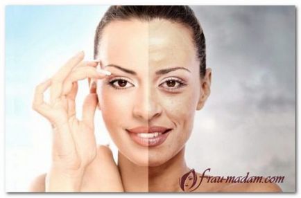 Hogyan hozza vissza a ragyogást és a frissességet az arcbőr ápoló termékek