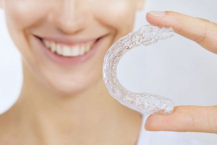 Kappa invisalign (invizibil) Aliniere transparentă pentru alinierea dinților