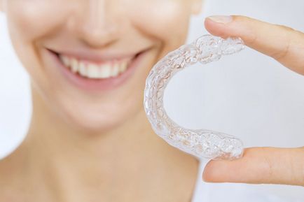 Капи invisalign (Инвизилайн) прозорі елайнери для вирівнювання зубів