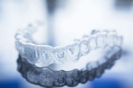 Капи invisalign (Инвизилайн) прозорі елайнери для вирівнювання зубів