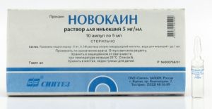 Міофасциальний больовий синдром шийного та інших відділів симптоми і лікування