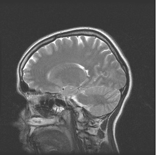 MRI az agy a vízparti negyedében 15 percig