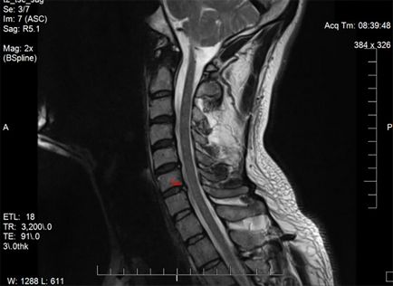 Mirt țesuturile moi ale gâtului și vaselor care arată pregătirea, contraindicațiile, decodificarea