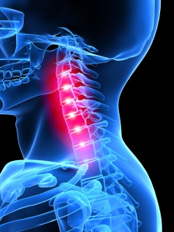 MR nyaki gerinc, a nyak vaszkuláris képalkotó