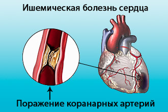 Zavarának intraventrikulas a szív - tünetek és kezelés