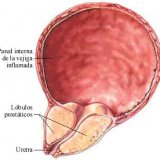 Metode netradiționale de tratare a bolilor ginecologice - bisturiu - medical