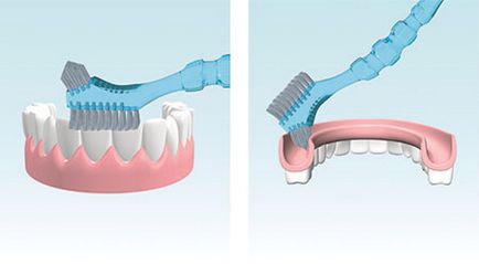 Нейлонові зубні протези переваги і недоліки